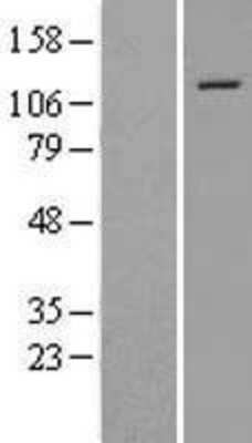 Western Blot: SNF2H Overexpression Lysate (Adult Normal) [NBL1-16228] Left-Empty vector transfected control cell lysate (HEK293 cell lysate); Right -Over-expression Lysate for SNF2H.