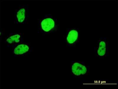 Immunocytochemistry/Immunofluorescence: SNF5 Antibody [H00006598-B01P] - Analysis of purified antibody to SMARCB1 on HeLa cell. (antibody concentration 10 ug/ml)
