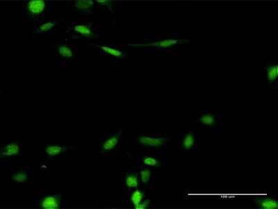 Immunocytochemistry/Immunofluorescence: SNF5 Antibody [H00006598-D03P] - Analysis of antibody to SMARCB1 on HeLa cell. Antibody concentration 30 ug/ml.