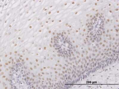 Immunohistochemistry-Paraffin: SNF5 Antibody [H00006598-B01P] - Analysis of purified antibody to SMARCB1 on formalin-fixed paraffin-embedded human esophagus. (antibody concentration 3 ug/ml)