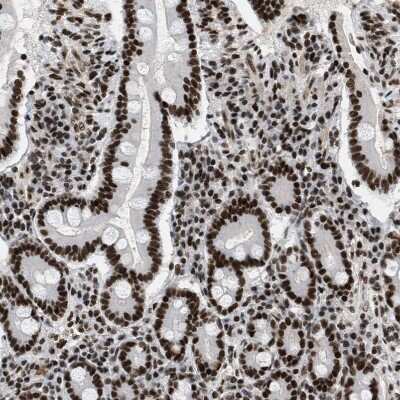 Immunohistochemistry-Paraffin: SNF5 Antibody [NBP1-90013] - Staining of human duodenum shows strong nuclear positivity in glandular cells.