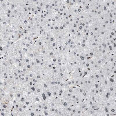 Immunohistochemistry-Paraffin: SNF5 Antibody [NBP1-90013] - Staining of human liver shows very weak positivity in hepatocytes as expected.