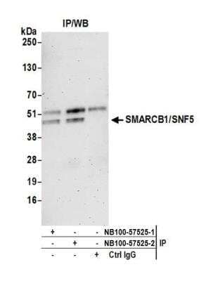 Immunoprecipitation: SNF5 Antibody [NB100-57525] - Detection of human SMARCB1/SNF5 by western blot of immunoprecipitates. Samples: Whole cell lysate (0.5 or 1.0 mg per IP reaction; 20% of IP loaded) from HeLa cells prepared using NETN lysis buffer. Antibody: Affinity purified rabbit anti-SMARCB1/SNF5 antibody NB100-57525 (lot NB100-57525-2) used for IP at 6 ug per reaction. SMARCB1/SNF5 was also immunoprecipitated by a previous lot of this antibody NB100-57525-1. For blotting immunoprecipitated SMARCB1/SNF5, NB100-57525 was used at 1 ug/ml. Detection: Chemiluminescence with an exposure time of 3 minutes.