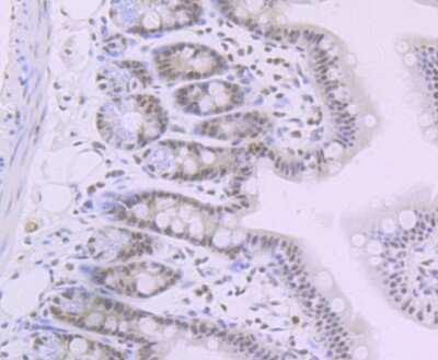 Immunohistochemistry-Paraffin: SNF5 Antibody (JB49-18) [NBP2-75669] - Analysis of paraffin-embedded mouse colon tissue using anti-SNF5 antibody. Counter stained with hematoxylin.