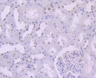 Immunohistochemistry-Paraffin: SNF5 Antibody (JB49-18) [NBP2-75669] - Analysis of paraffin-embedded rat kidney tissue using anti-SNF5 antibody. Counter stained with hematoxylin.