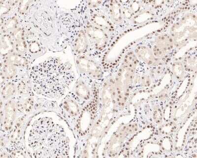 Immunohistochemistry-Paraffin: SNF5 Antibody (JB49-18) [NBP2-75669] - Analysis of paraffin-embedded human kidney tissue with Rabbit anti-SNF5 antibody washed with ddH2O and PBS, and then probed with the primary antibody at 1/200 dilution for 1 hour at room temperature. The detection was performed using an HRP conjugated compact polymer system. DAB was used as the chromogen. Tissues were counterstained with hematoxylin and mounted with DPX.