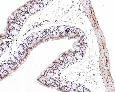 Immunohistochemistry-Paraffin: SNF5 Antibody (JB49-18) [NBP2-75669] - Analysis of paraffin-embedded mouse large intestine tissue with Rabbit anti-SNF5 antibody washed with ddH2O and PBS, and then probed with the primary antibody  at 1/500 dilution for 1 hour at room temperature. The detection was performed using an HRP conjugated compact polymer system. DAB was used as the chromogen. Tissues were counterstained with hematoxylin and mounted with DPX.