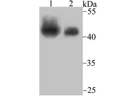 Western Blot: SNF5 Antibody (JB49-18) [NBP2-75669] - Analysis of SNF5 on Daudi cell and mouse lymph node tissue lysates using anti-SNF5 antibody at 1/500 dilution.