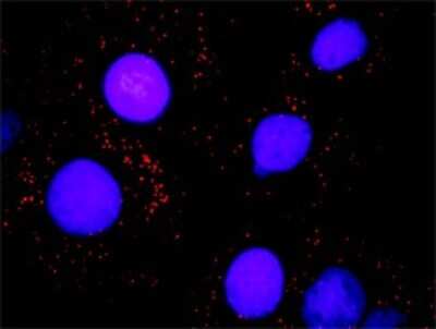 Proximity Ligation Assay: SNF5 Antibody [H00006598-D01P] - Analysis of protein-protein interactions between SMARCB1 and BAZ1B. Huh7 cells were stained with anti-SMARCB1 rabbit purified polyclonal 1:1200 and anti-BAZ1B mouse monoclonal antibody 1:50. Each red dot represents the detection of protein-protein interaction complex, and nuclei were counterstained with DAPI (blue).