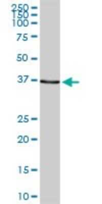 Western Blot: SNF5 Antibody [H00006598-D01P] - Analysis of SMARCB1 expression in mouse intestine.