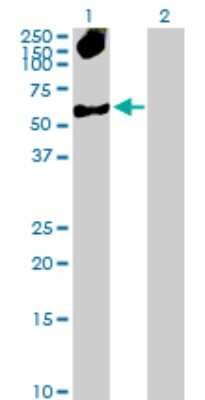 Western Blot: SNF5 Antibody [H00006598-D01P] - Analysis of SMARCB1 expression in transfected 293T cell line by SMARCB1 polyclonal antibody.Lane 1: SMARCB1 transfected lysate(44.10 KDa).Lane 2: Non-transfected lysate.