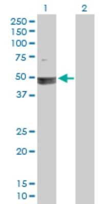 Western Blot: SNF5 Antibody [H00006598-D03P] - Analysis of SMARCB1 expression in transfected 293T cell line by SMARCB1 polyclonal antibody.Lane 1: SMARCB1 transfected lysate(44.1 KDa).Lane 2: Non-transfected lysate.