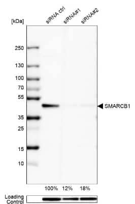 Western Blot: SNF5 Antibody [NBP1-90013] - Analysis in HEK293 cells transfected with control siRNA, target specific siRNA probe #1 and #2,. Remaining relative intensity is presented. Loading control: Anti-GAPDH.