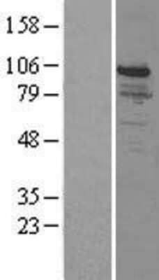 Western Blot: SNF5 Overexpression Lysate (Adult Normal) [NBP2-04243] Left-Empty vector transfected control cell lysate (HEK293 cell lysate); Right -Over-expression Lysate for SNF5.