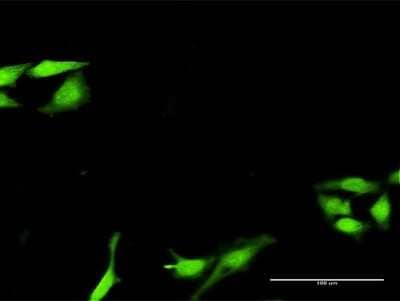 Immunocytochemistry/Immunofluorescence: SNF8 Antibody [H00011267-D01P] - Analysis of antibody to SNF8 on HeLa cell. Antibody concentration 30 ug/ml.