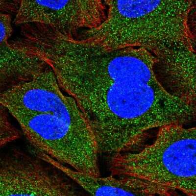 Immunocytochemistry/Immunofluorescence: SNF8 Antibody [NBP2-32449] - Immunofluorescent staining of human cell line U-2 OS shows localization to cytosol.