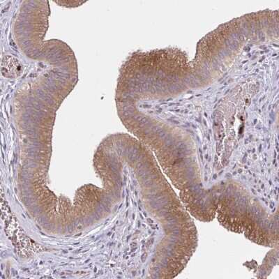 Immunohistochemistry-Paraffin: SNF8 Antibody [NBP2-32449] - Staining of human gallbladder shows strong cytoplasmic positivity in glandular cells.