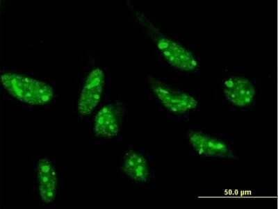 Immunocytochemistry/Immunofluorescence: SNIP1 Antibody [H00079753-B01P] - Analysis of purified antibody to SNIP1 on HeLa cell. (antibody concentration 10 ug/ml)