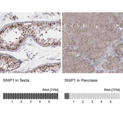 <b>Orthogonal Strategies Validation. </b>Immunohistochemistry-Paraffin: SNIP1 Antibody [NBP1-89428] - Staining in human testis and pancreas tissues using anti-SNIP1 antibody. Corresponding SNIP1 RNA-seq data are presented for the same tissues.