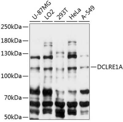 Western Blot: SNM1 Antibody [NBP2-93239] - Analysis of extracts of various cell lines, using SNM1 at 1:3000 dilution.Secondary antibody: HRP Goat Anti-Rabbit IgG (H+L) at 1:10000 dilution.Lysates/proteins: 25ug per lane.Blocking buffer: 3% nonfat dry milk in TBST.Detection: ECL Basic Kit .Exposure time: 30s.