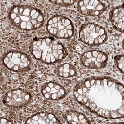 Immunohistochemistry-Paraffin: SNRNP27 Antibody [NBP1-80808] - Staining of human rectum shows strong nuclear positivity in glandular cells.