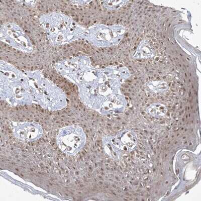 Immunohistochemistry-Paraffin: SNRNP27 Antibody [NBP1-80808] - Staining of human skin shows moderate nuclear positivity in squamous epithelial cells.