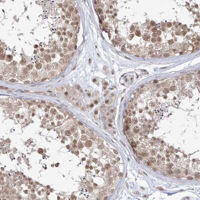 Immunohistochemistry-Paraffin: SNRNP27 Antibody [NBP1-80808] - Staining of human testis shows moderate nuclear positivity in Leydig cells and cells in seminiferous ducts.