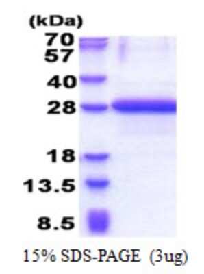 SDS-PAGE Recombinant Human OBFC2A His Protein