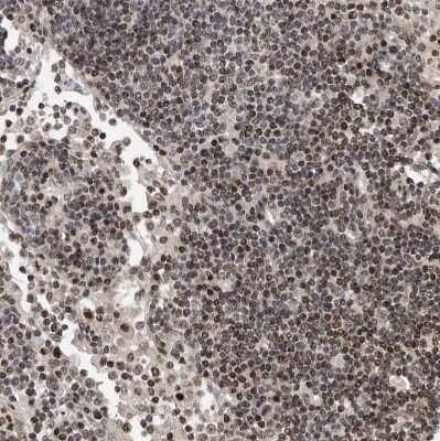 Immunohistochemistry-Paraffin: SNRNP48 Antibody [NBP1-86760] - Staining of human lymph node shows moderate to strong nuclear positivity in non-germinal center cells.