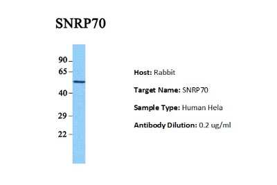 Western Blot SNRP70 Antibody