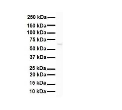 Western Blot SNRP70 Antibody