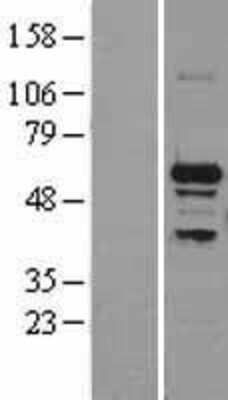 Western Blot SNRP70 Overexpression Lysate