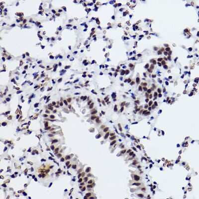 Immunohistochemistry-Paraffin: SNRPA1 Antibody (2D7M1) [NBP3-15292] - Immunohistochemistry of paraffin-embedded mouse lung using SNRPA1 Rabbit mAb (NBP3-15292) at dilution of 1:100 (40x lens).Perform high pressure antigen retrieval with 10 mM citrate buffer pH 6.0 before commencing with IHC staining protocol.