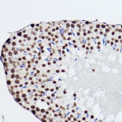 Immunohistochemistry-Paraffin: SNRPA1 Antibody (2D7M1) [NBP3-15292] - Immunohistochemistry of paraffin-embedded rat testis using SNRPA1 Rabbit mAb (NBP3-15292) at dilution of 1:100 (40x lens).Perform high pressure antigen retrieval with 10 mM citrate buffer pH 6.0 before commencing with IHC staining protocol.