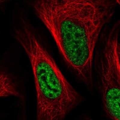 Immunocytochemistry/Immunofluorescence: SNRPA1 Antibody [NBP2-33447] - Immunofluorescent staining of human cell line U-2 OS shows localization to nuclear speckles.