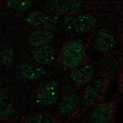 Immunocytochemistry/Immunofluorescence: SNRPA1 Antibody [NBP2-33528] - Staining of human cell line RT4 shows localization to nucleoplasm & nuclear bodies.