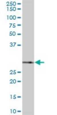 Western Blot: SNRPA1 Antibody [H00006627-B01P] - Analysis of SNRPA1 expression in human liver.