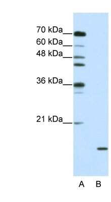 Western Blot: SNRPA1 Antibody [NBP1-57239] - Jurkat cell lysate, Antibody Titration: 2.5ug/ml