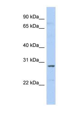 Western Blot: SNRPA1 Antibody [NBP1-57240] - Human Liver cell lysate, concentration 0.2-1 ug/ml.