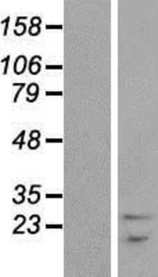 Western Blot: SNRPB Overexpression Lysate (Adult Normal) [NBP2-04686] Left-Empty vector transfected control cell lysate (HEK293 cell lysate); Right -Over-expression Lysate for SNRPB.