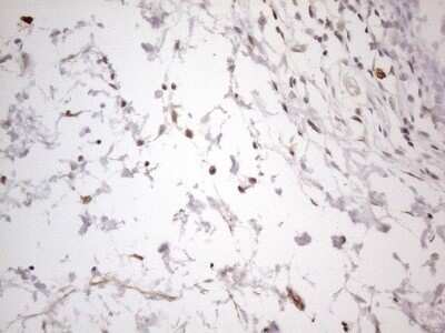 Immunohistochemistry: SNRPB2 Antibody (OTI2A5) - Azide and BSA Free [NBP2-74260] - Analysis of Human bladder tissue. (Heat-induced epitope retrieval by 1mM EDTA in 10mM Tris buffer (pH8.5) at 120C for 3 min)