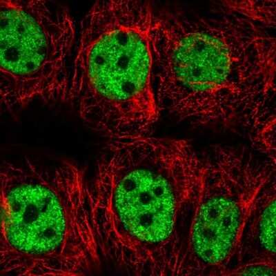 Immunocytochemistry/Immunofluorescence: SNRPC Antibody [NBP2-38755] - Immunofluorescent staining of human cell line MCF7 shows localization to nucleoplasm.