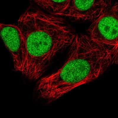 Immunocytochemistry/Immunofluorescence: SNRPC Antibody [NBP2-59011] - Staining of human cell line MCF7 shows localization to nucleoplasm.