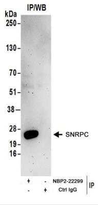 Immunoprecipitation: SNRPC Antibody [NBP2-22299] - Whole cell lysate (1 mg for IP; 20% of IP loaded) from HeLa cells.  NBP2-22299 used for IP at 6 ug/mg lysate.  For blotting immunoprecipitated U1C, NBP2-22299 was used at 1 ug/ml.  Detection: Chemiluminescence with an exposure time of 3 minutes.