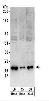 Western Blot: SNRPC Antibody [NBP2-22299] - Whole cell lysate from HeLa (15 and 50 ug), and 293T (50ug) cells.   NBP2-22299 used for WB at 0.4 ug/ml.  Detection: Chemiluminescence with an exposure time of 3 minutes.