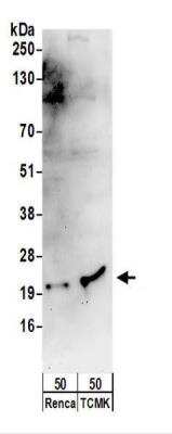 Western Blot: SNRPC Antibody [NBP2-22299] - Whole cell lysate (50 ug) from Renca and TCMK-1 cells.  NBP2-22299 used for WB at 1 ug/ml.  Detection: Chemiluminescence with an exposure time of 3 minutes.