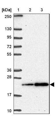 Western Blot: SNRPC Antibody [NBP2-38755] - Lane 1: Marker  [kDa] 250, 130, 95, 72, 55, 36, 28, 17, 10.  Lane 2: Human cell line RT-4.  Lane 3: Human cell line U-251MG