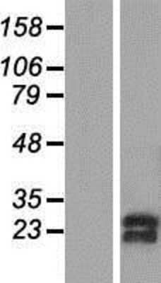 Western Blot SNRPC Overexpression Lysate