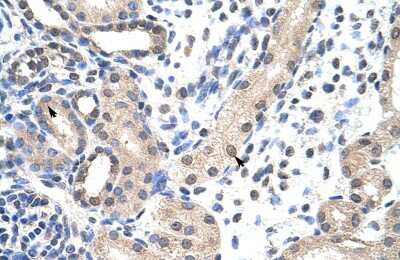 Immunohistochemistry-Paraffin SNRPD1 Antibody - BSA Free