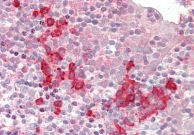 Immunohistochemistry-Paraffin SNRPD1 Antibody - BSA Free